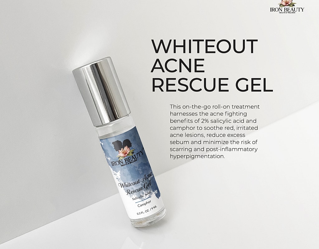 Whiteout Acne Rescue Gel product with applicator.