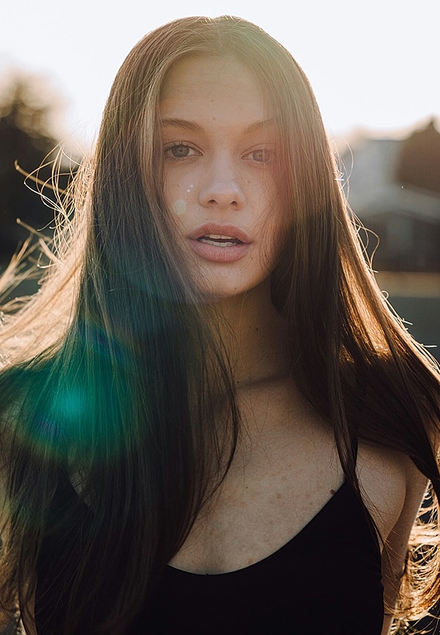 Wasilla Lip Augmentation model with flowing hair in sunlight.